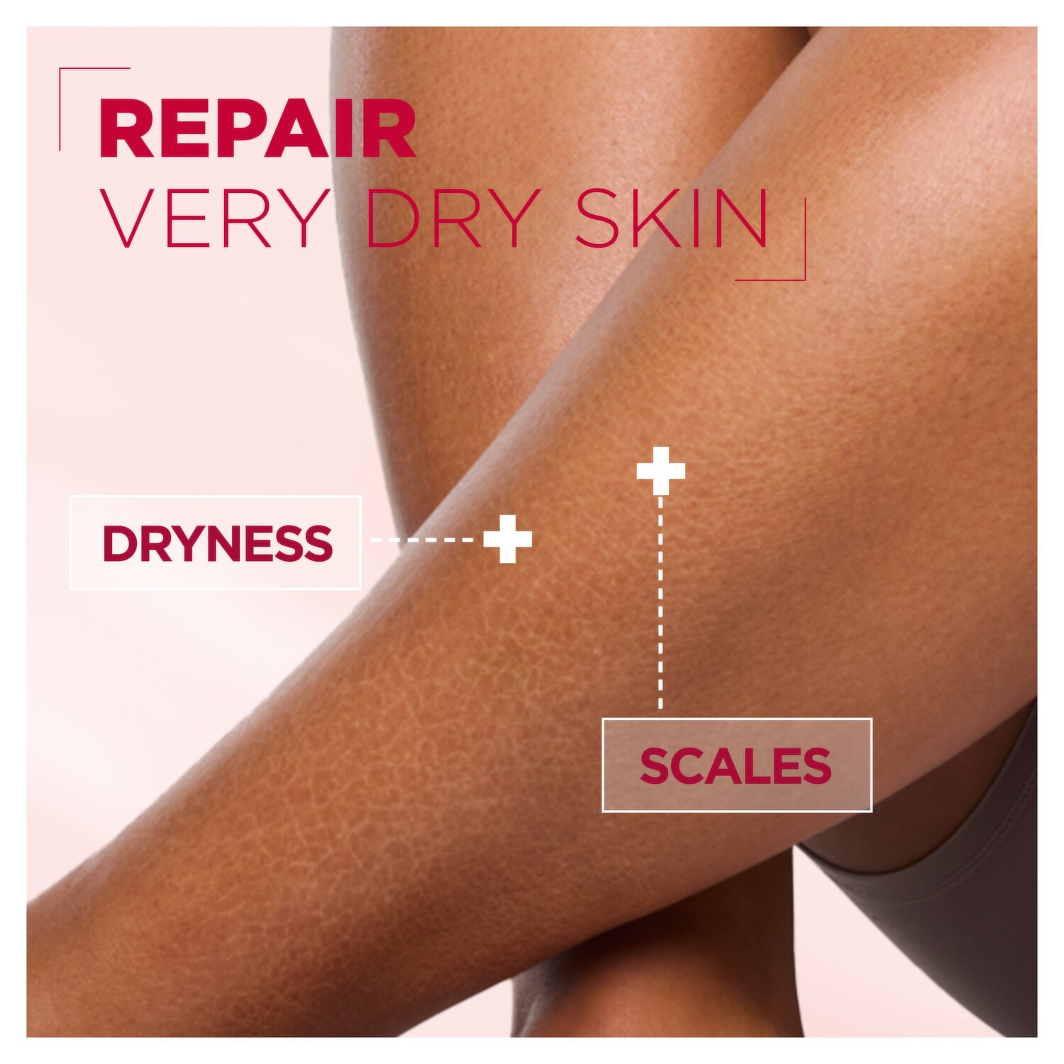 Mixa Urea Panthenol Cica Repair+ Lotion Réparatrice 5 % Urée, Panthénol & Cica 250ml – Image 3