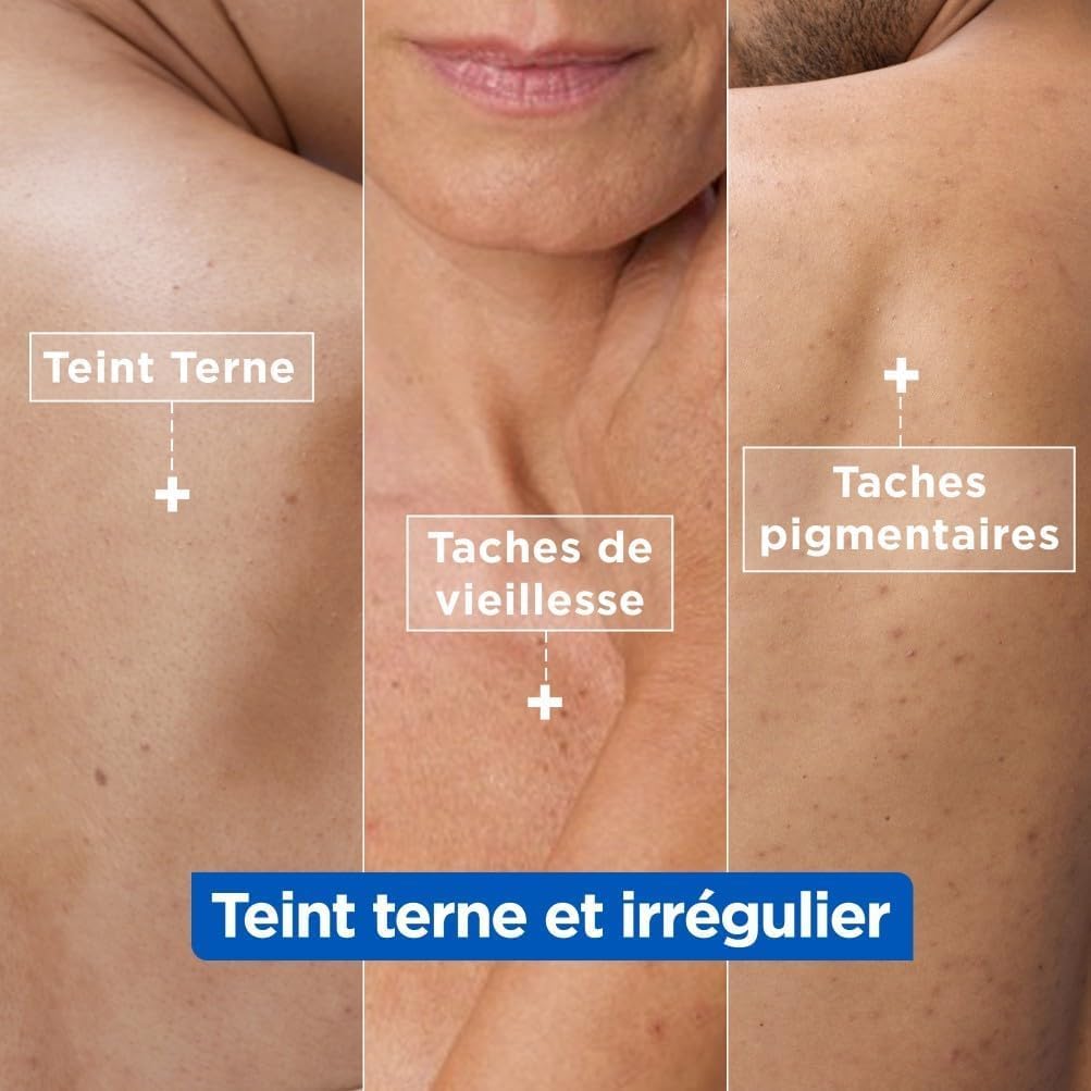 Mixa Crème Niacinamide Anti-Taches et Uniformisante 400ml – Image 3