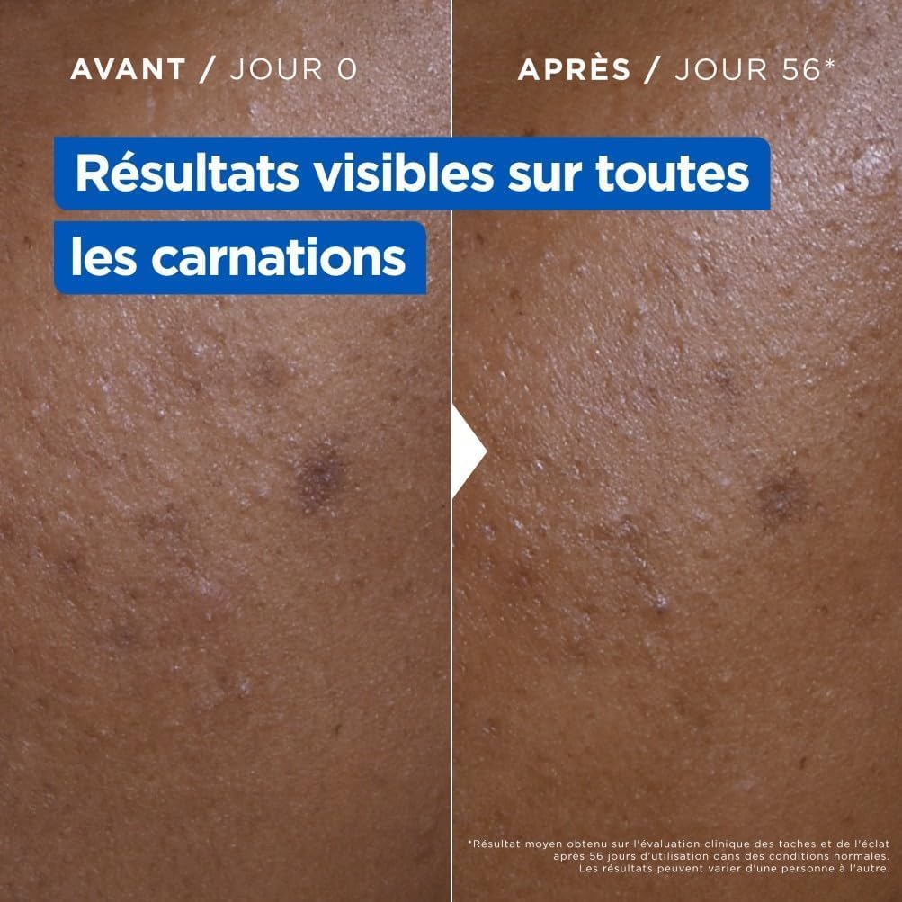 Mixa Crème Niacinamide Anti-Taches et Uniformisante 400ml – Image 5