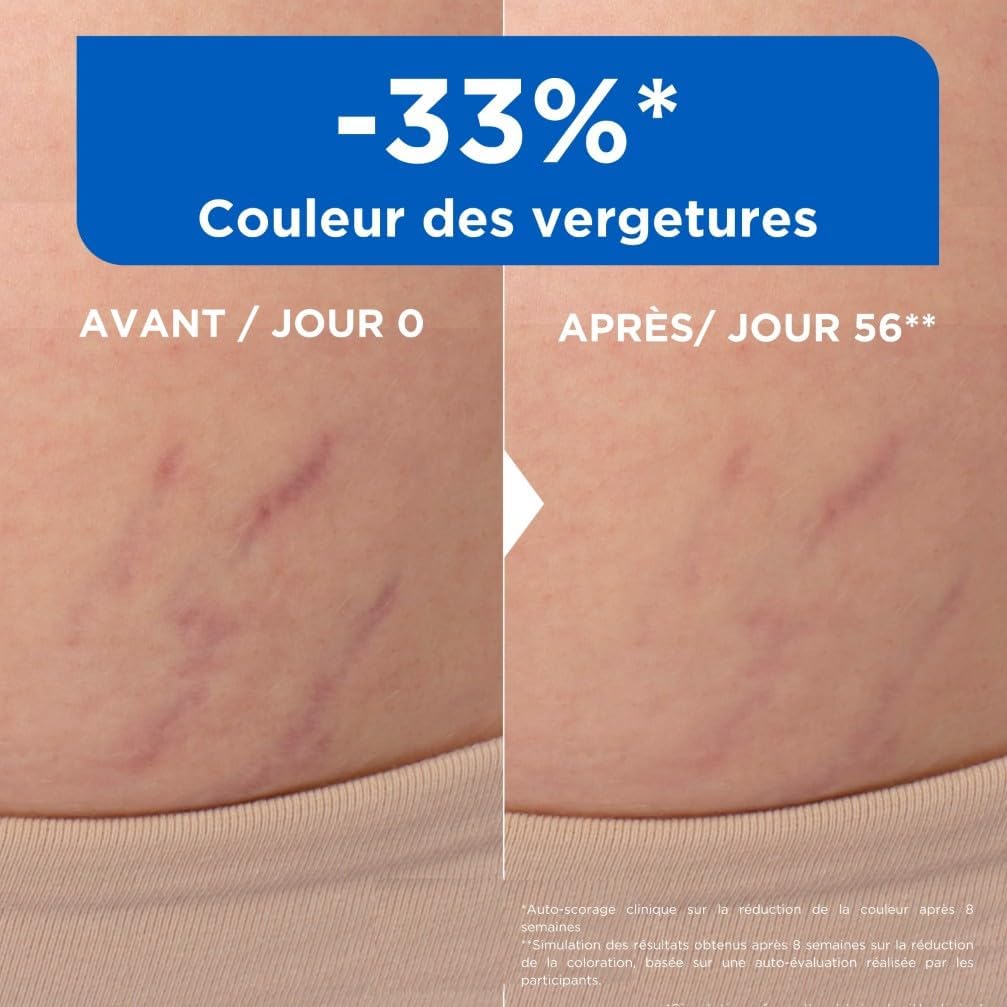 Mixa Huile Anti-Vergetures aux Omégas 6 & 9 – 100 ml – Image 5
